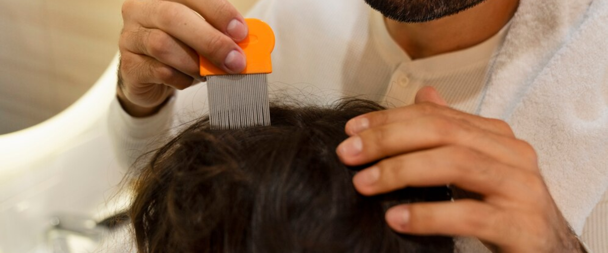 You are currently viewing Dandruff Treatment