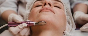 Read more about the article Dermal fillers at Lalith