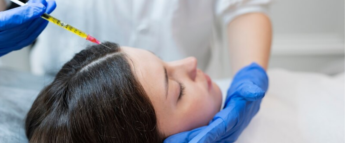 Read more about the article Platelet-rich plasma hair treatment
